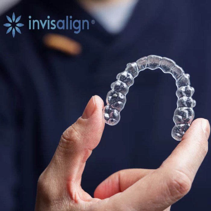 How Much Does Invisalign Cost in Los Angeles - NoHo Family Dental